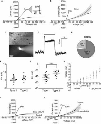 Two Functional Classes of Rod Bipolar Cells in the Healthy and Degenerated Optogenetically Treated Murine Retina